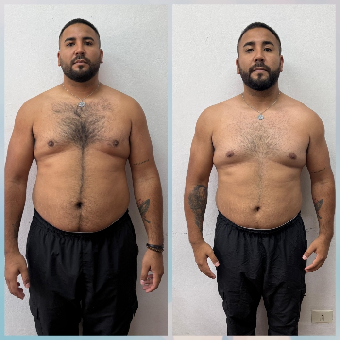 Transformación de Andres Cañete: antes y después